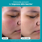 Paulas Choice Skin Perfecting 2% BHA Exfoliating Toner