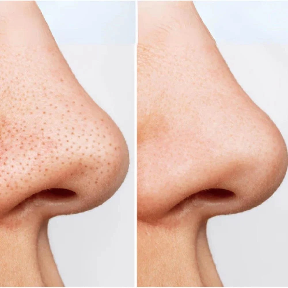 ANUA - Heartleaf Quercetinol Pore Deep Cleansing Foam