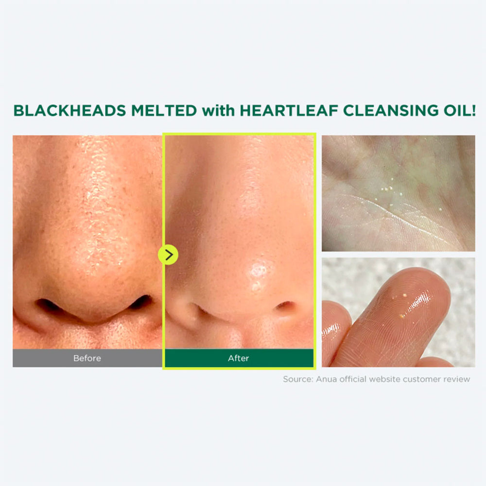 ANUA - Heartleaf Pore Control Cleansing Oil - 200ml