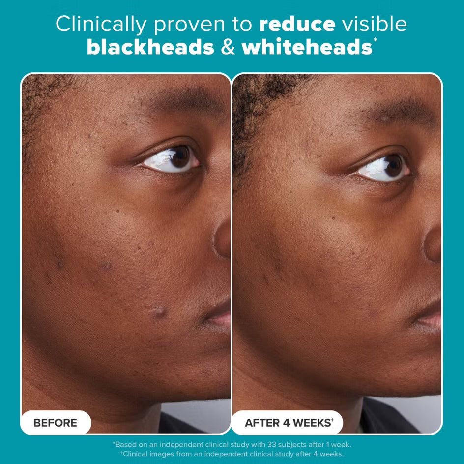 Paulas Choice Skin Perfecting 2% BHA Exfoliating Toner