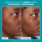 Paulas Choice Skin Perfecting 2% BHA Exfoliating Toner