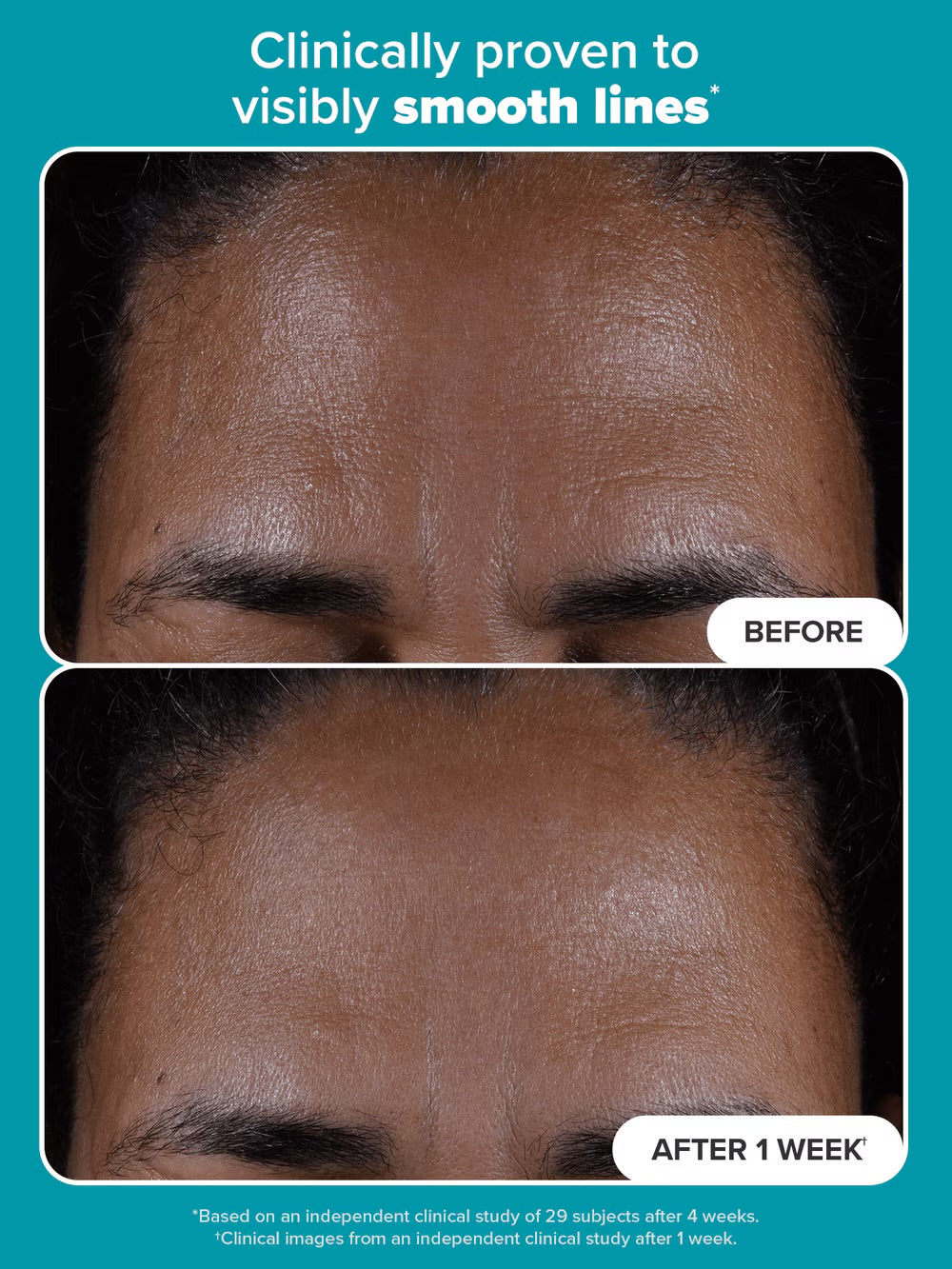 Paulas Choice Skin Perfecting 2% BHA Exfoliating Toner