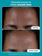 Paulas Choice Skin Perfecting 2% BHA Exfoliating Toner