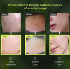 ANUA - Heartleaf 77% Soothing Toner