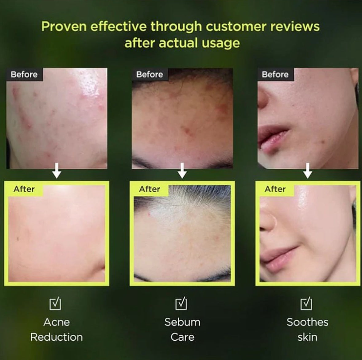 ANUA - Heartleaf 77% Soothing Toner