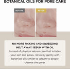 SKIN1004 Madagascar Centella Light Cleansing Oil